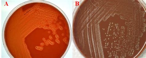 CULTURE OF CEREBROSPINAL FLUID (CSF) - #1 Microbiology Resource Hub