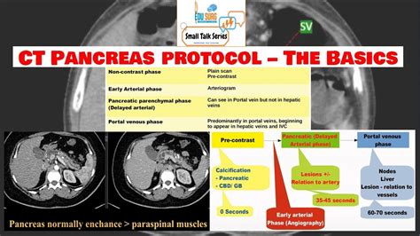 CT scan of the pancreas - pancreas protocol CT scan - Imaging of the ...