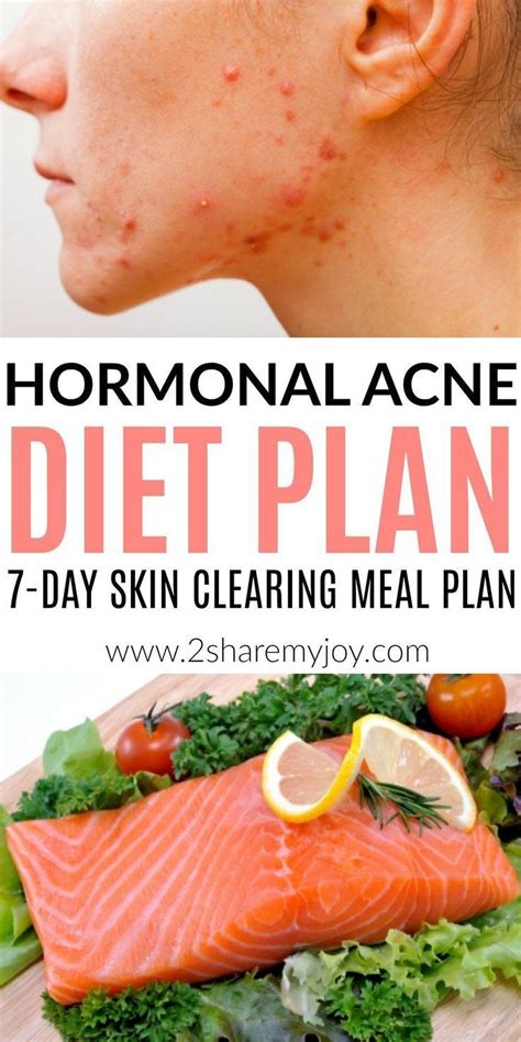 Hormonal Acne Diet Plan (best 7-day clear skin meal plan) | Clear skin ...