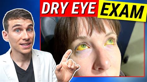 The Most Thorough Dry Eye Examination - Dry Eyes Testing Explained