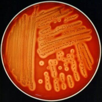 Staphylococcus aureus