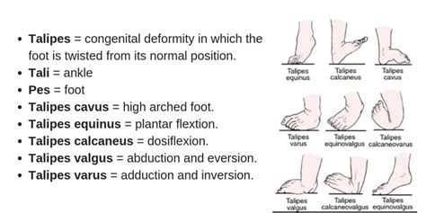 Congenital Talipes Equinovarus (Clubfoot) Nursing Management - RNpedia ...