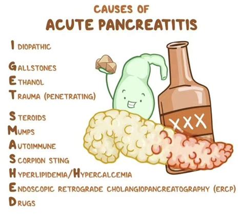 Pancreatitis Causes