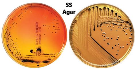 Salmonella Shigella (SS) Agar - Microbiology Notes