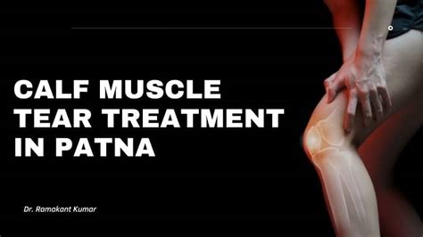 Dr. Ramakant Kumar – Best for Calf Muscle Tear Treatment in Patna