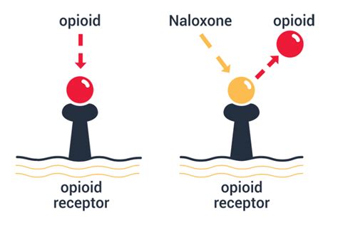 About Naloxone (Narcan™) - Overdose Lifeline