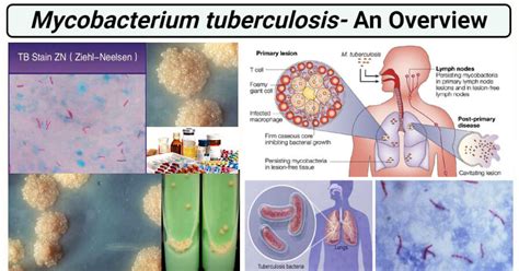 Mycobacterium tuberculosis- An Overview - Microbe Notes