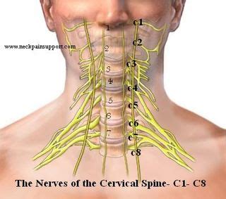 Cervical Fusion Mid Cervical - Morphopedics