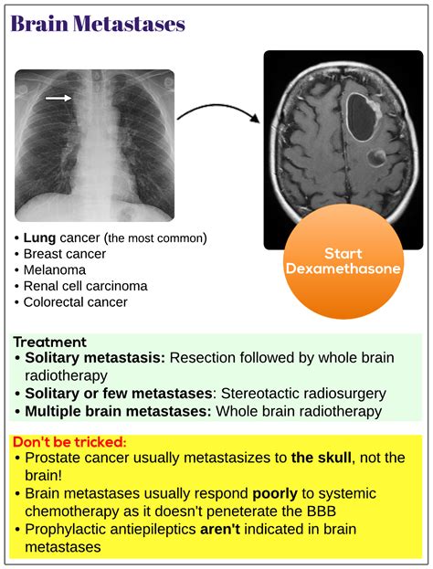 Brain metastases - Medicine Keys for MRCPs