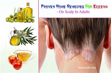 26 Proven Home Remedies For Eczema On Scalp In Adults & Kids