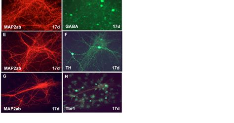 Differentiation and maturation of GABAergic, dopaminergic and ...