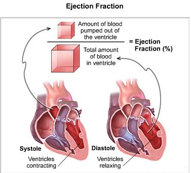 Dealing with huff-puff? Think HFpEF | Lab Land