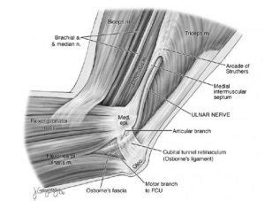 Medial Epicondylitis | Sport Med School