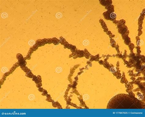 Bacteria And Fungi Under The Microscope Royalty-Free Stock Photography ...