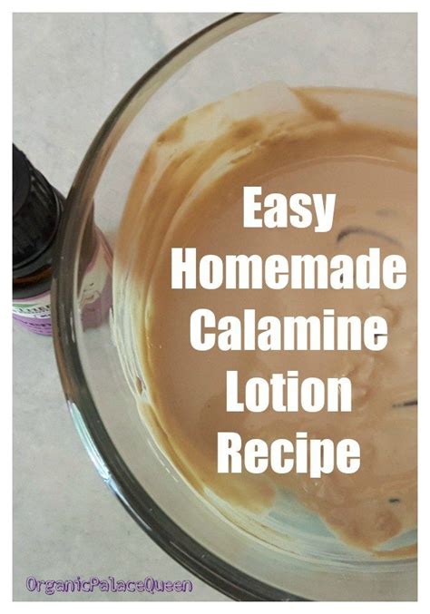 How To Make My Own Calamine Lotion - Organic Palace Queen | Calamine ...