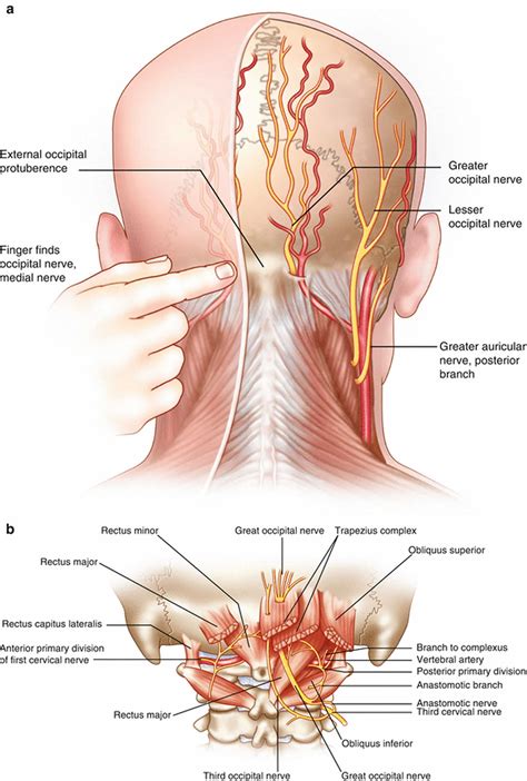 Occipital neuralgia causes, symptoms, diagnosis, treatment & prognosis