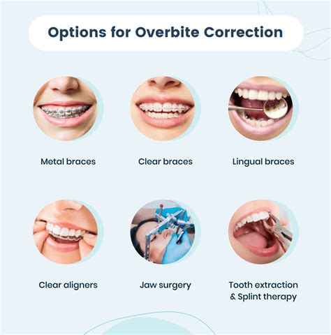 Unveiling the Journey of Correcting an Overbite – A Timeline to a ...