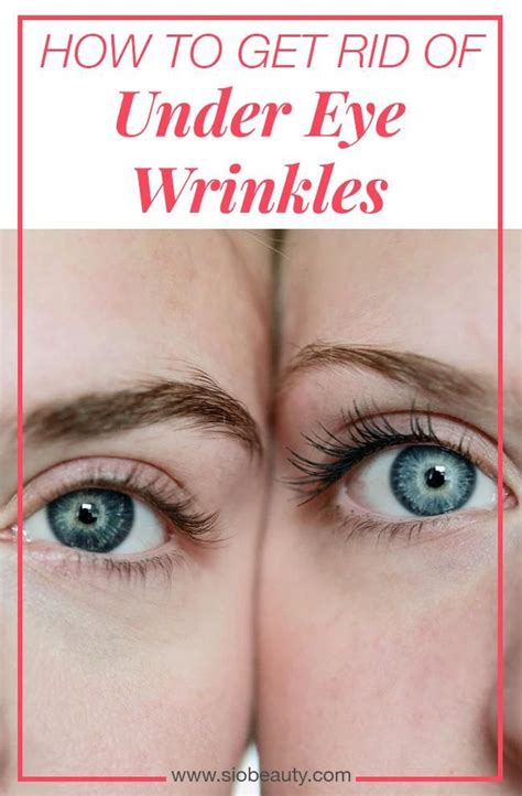 The Best Home Remedies For Under-Eye Wrinkles | Under eye wrinkles, Eye ...