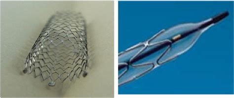 Left: bare metal stent and right: bare metal stent with inflated ...