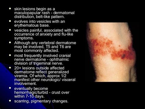 Trigeminal neuralgia, herpetic neuralgia, myofascial pains