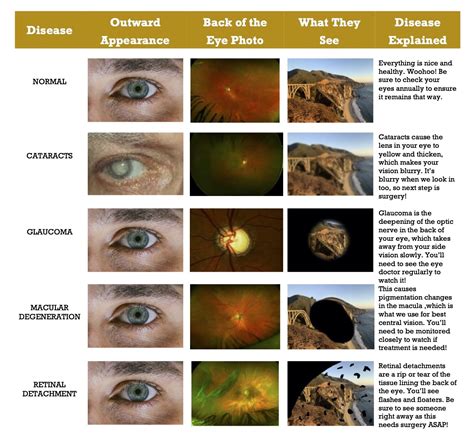 Eye Diseases Chart