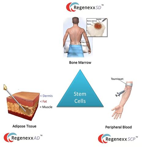 Having Many Stem Cell Sources in the Toolbox benefits the Patient