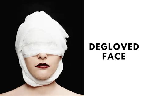 Degloved Face Injuries: Causes, Treatment, and Prevention