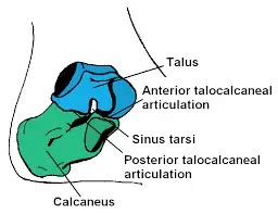 Subtalar Joint Arthritis: Causes, Symptoms, Diagnosis & Treatment