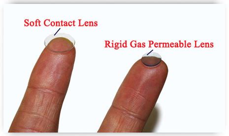 Keratoconus Contact Lens Fittings