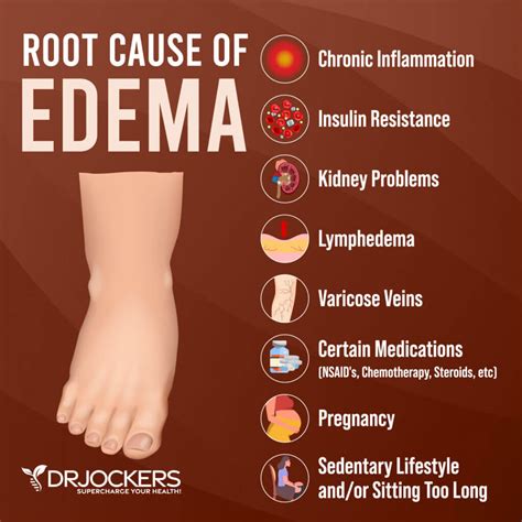 Edema: Symptoms, Causes, and Natural Support Strategies