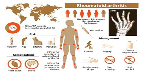 Natural Treatment for Rheumatoid Arthritis | Vitalia