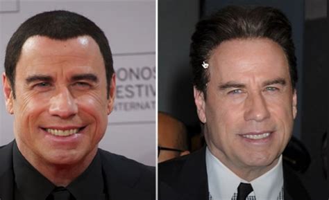 Has John Travolta been Wearing a Wig?