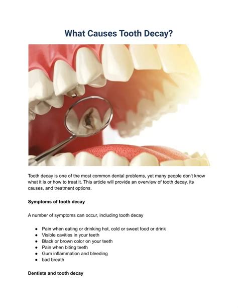 PPT - What Causes Tooth Decay PowerPoint Presentation, free download ...