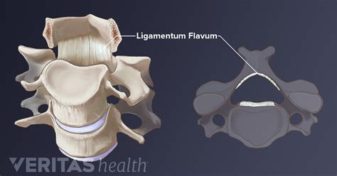 Ligamentum Flavum Definition | Back Pain and Neck Pain Medical Glossary