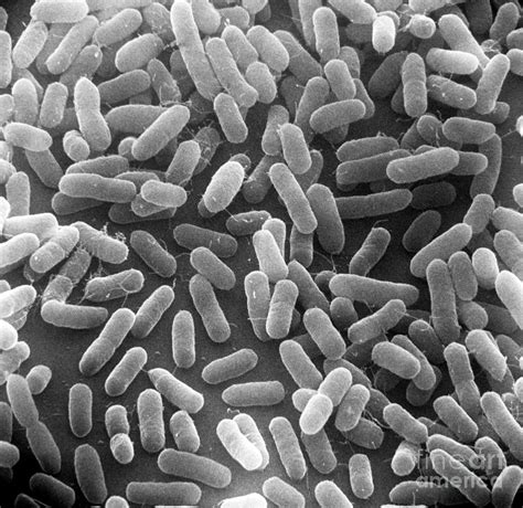 Bacteria E Coli Electron Microscope - Micropedia