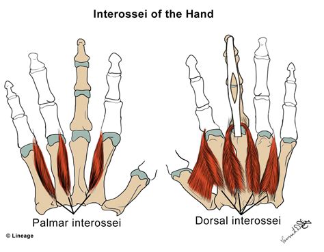 Intrinsic Hand Muscles - MSK - Medbullets Step 1