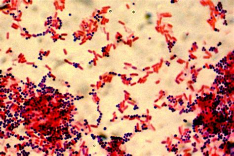 Staphylococcus Aureus Acid Fast Stain