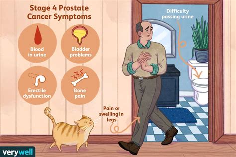 Stage 4 Prostate Cancer Treatments and Prognosis