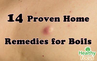 14 Proven Home Remedies for Boils - Healthy Focus