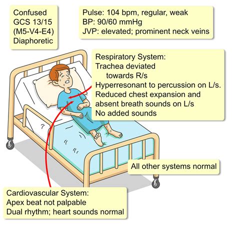 Tension Pneumothorax - Interactive case study | Clinical Odyssey by ...