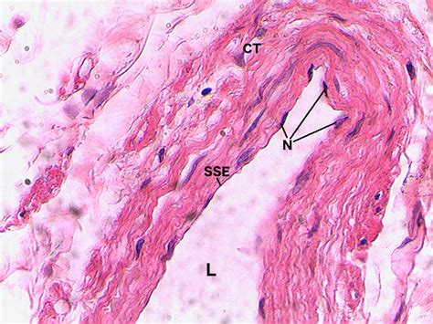 Simple Squamous Epithelium Slide Labeled