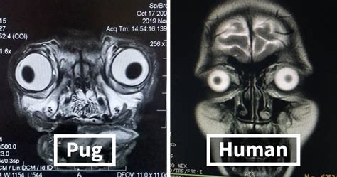 Someone Shows What A Pug’s MRI Scan Looks Like And It’s Pretty ...