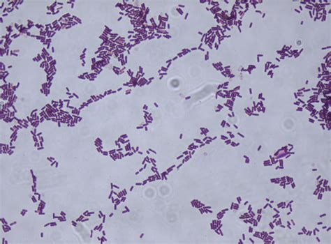 Bacillus Gram Stain Images & Pictures - Becuo