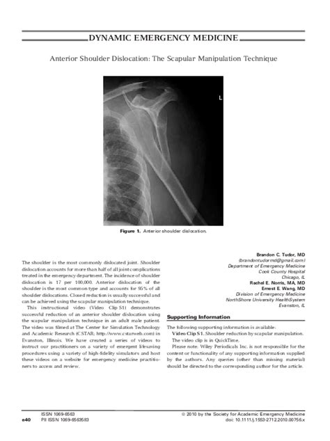 (PDF) Anterior Shoulder Dislocation: The Scapular Manipulation ...