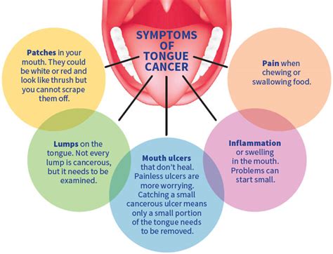 Tongue Cancer- Stages, Causes, Symptoms & Preventions