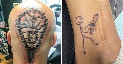 16 People Who Used the Art of Tattoos to Cover Up Their Scars / Bright Side