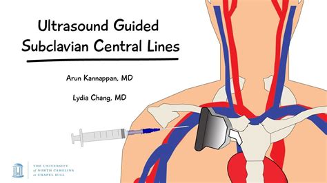 Anatomy Of Subclavian Vein - Anatomical Charts & Posters