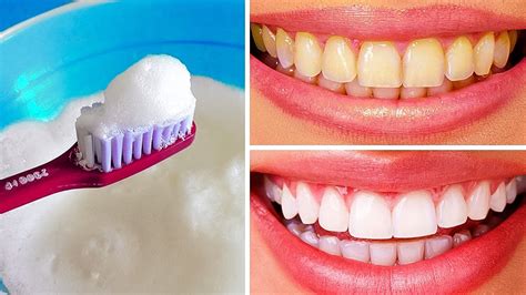 The Best Way To Whiten Teeth At Home - TeethWalls