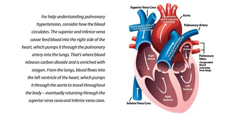 Pulmonary Hypertension | What's Up at Upstate | SUNY Upstate