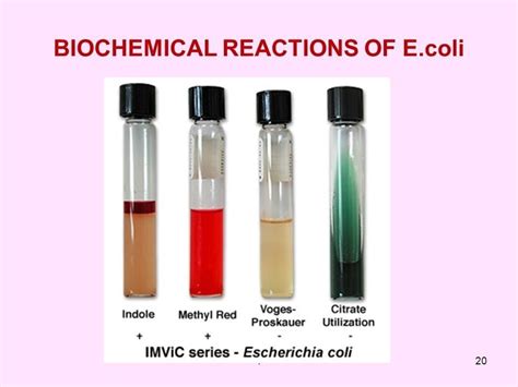 Biochemical tests for identification of Gram negative bacteria